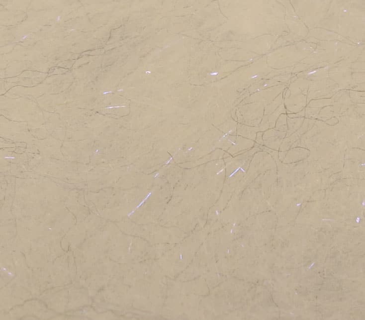 Senyo's Laser Dub